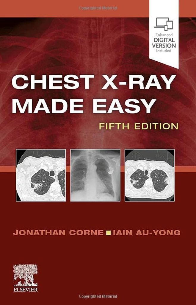 Top 10 Best Books To Learn Chest X-ray - TheMDJourney